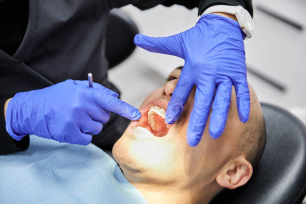 Best Emergency Tooth Extraction in Lewisville, NC
